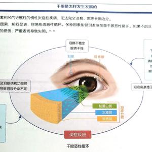 阿闲干眼头像