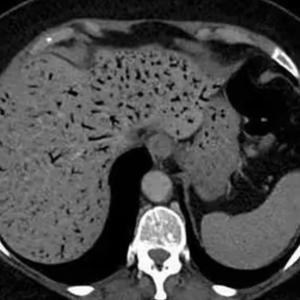 肺炎淋球菌 头像